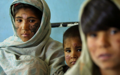 ¿Cómo afecta la leishmaniasis al ser humano? Informe de la Organización Mundial de la Salud.